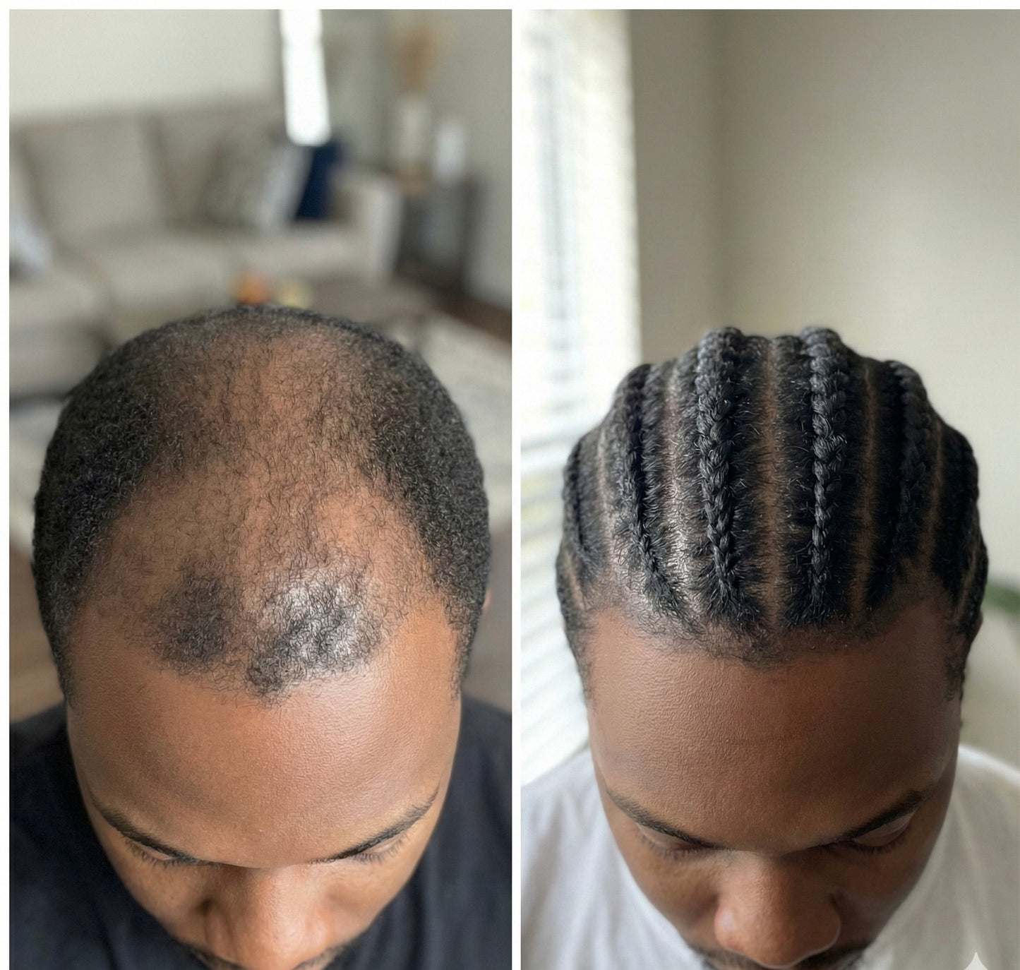 DHT Blocker Nourishing Hair Growth Oil