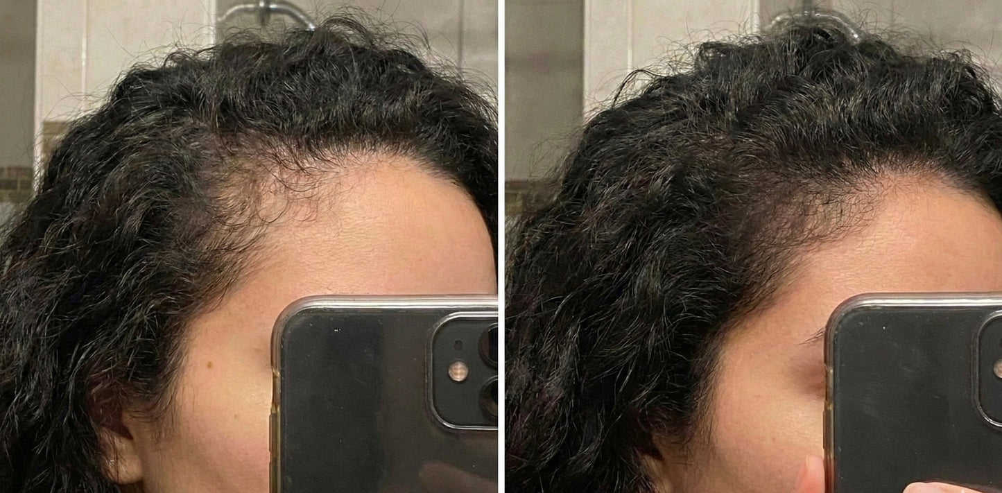 DHT Blocker Nourishing Hair Growth Oil